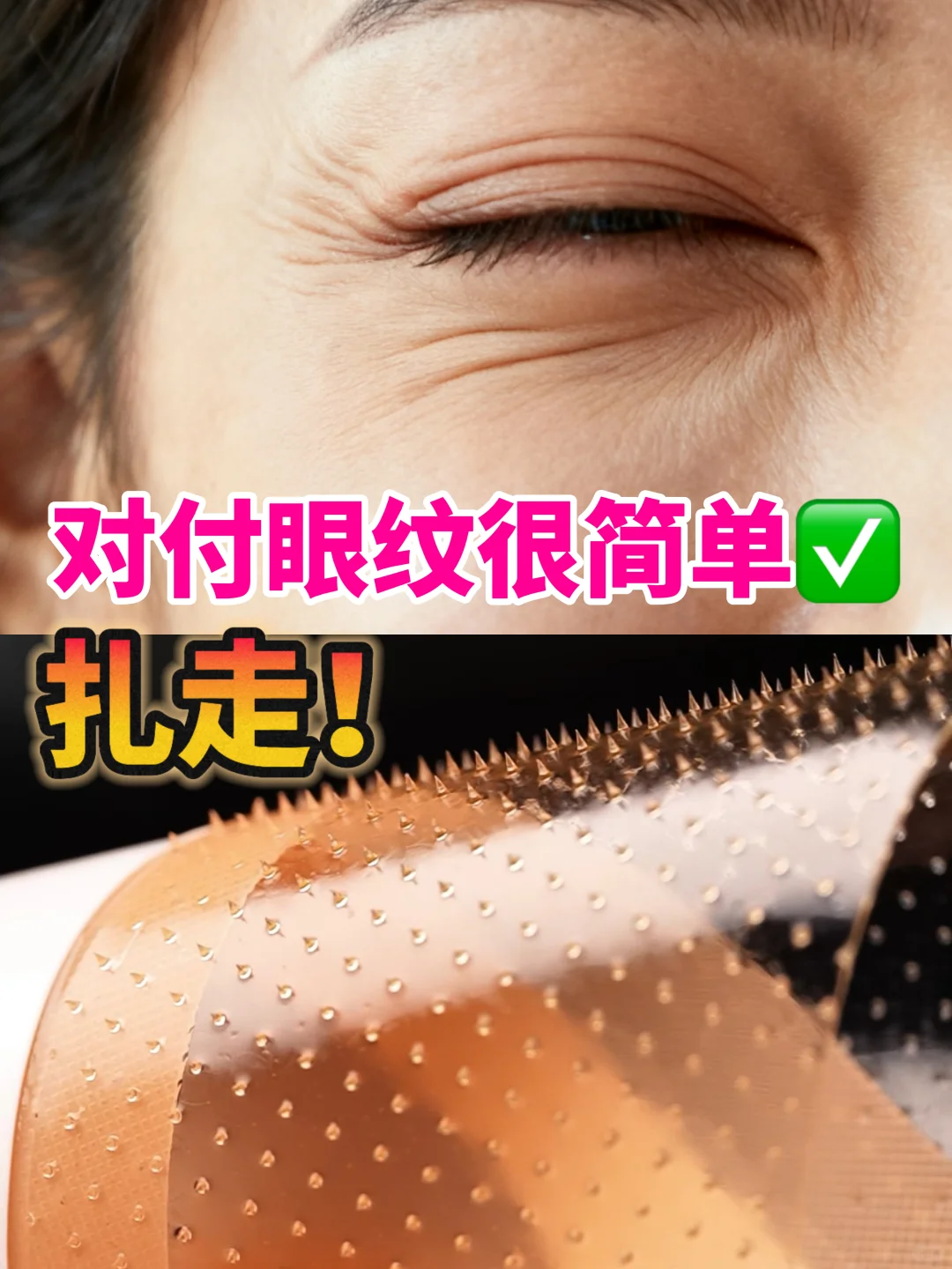 扎走！对付眼纹快还有效！