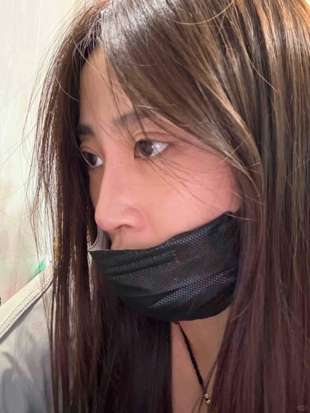 打完爱贝芙第7天