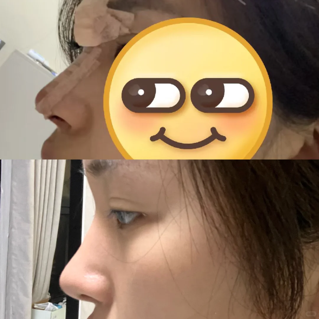 想重弄了👃🏻