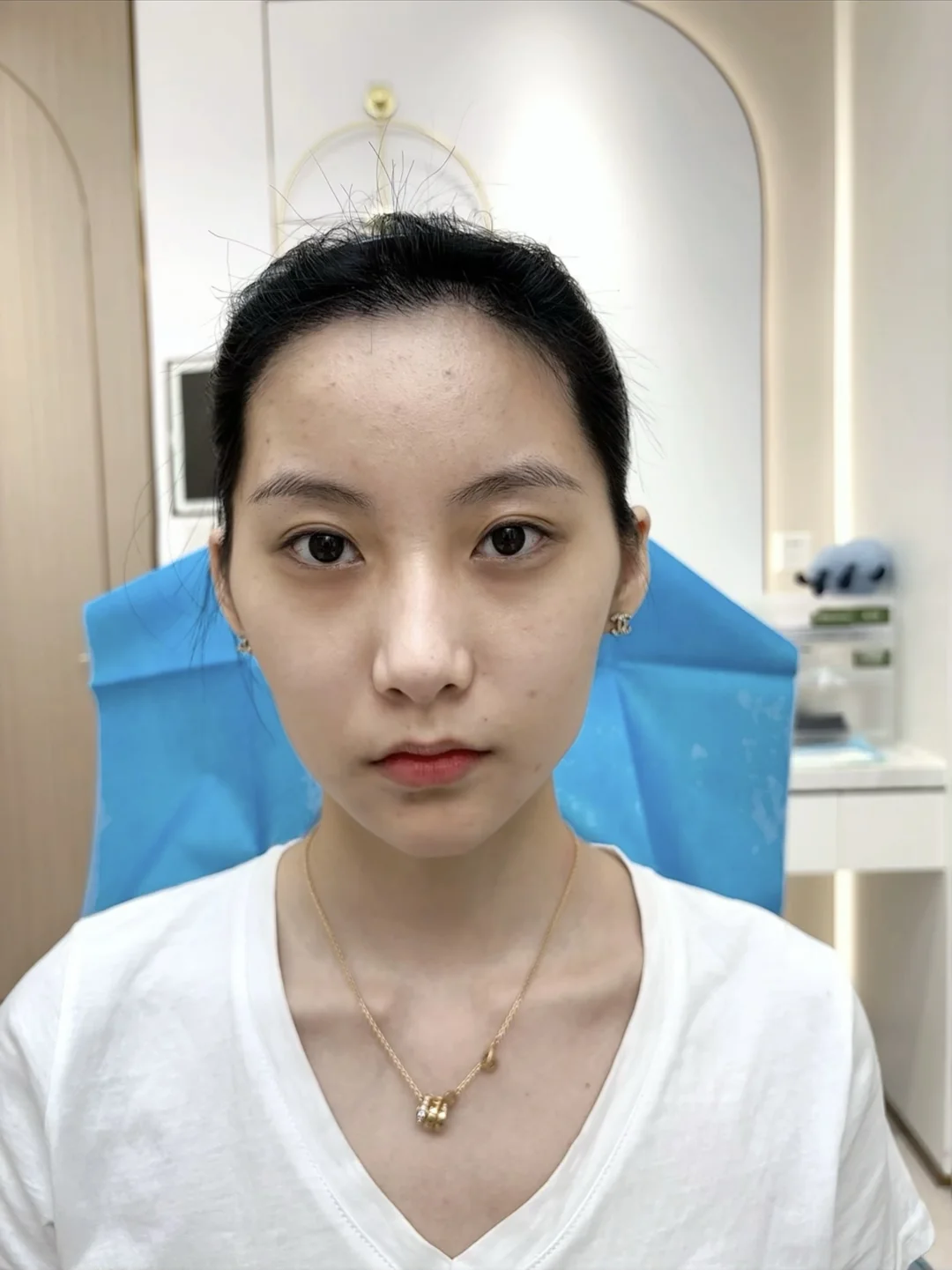 菱形脸do完太绝了！