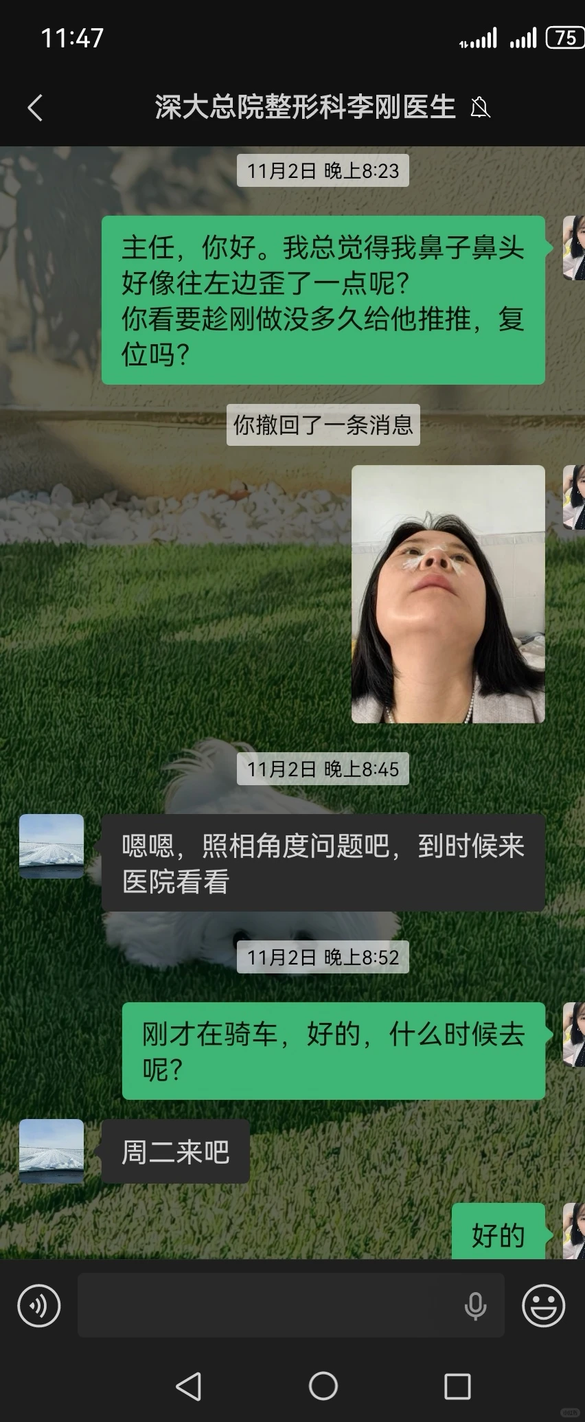 想到就生气，隆鼻