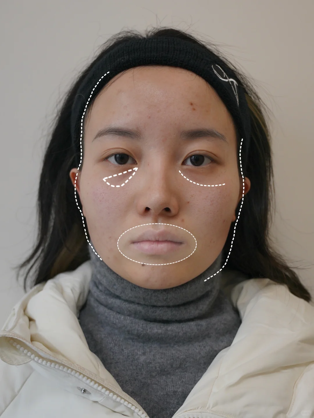 预算一万五👏面部轮廓流畅美爆了