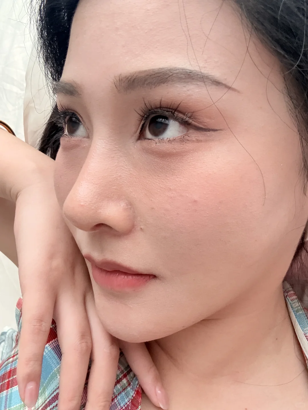 鼻子做完一个月啦！原相机