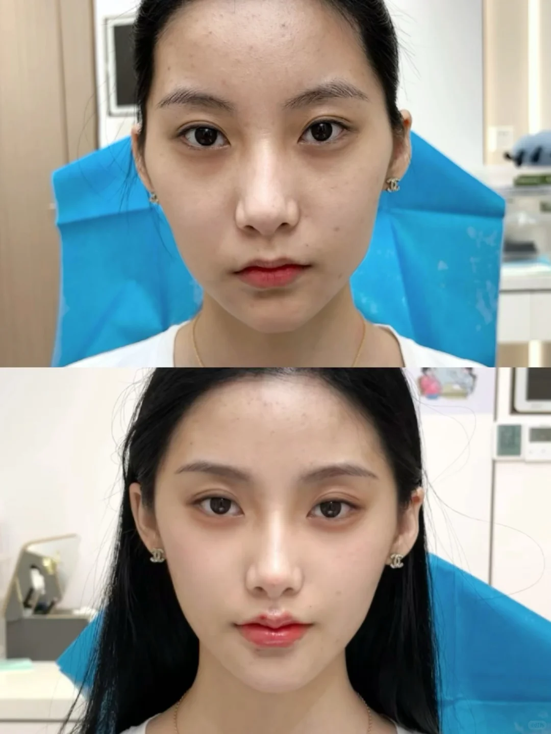 菱形脸do完太绝了！