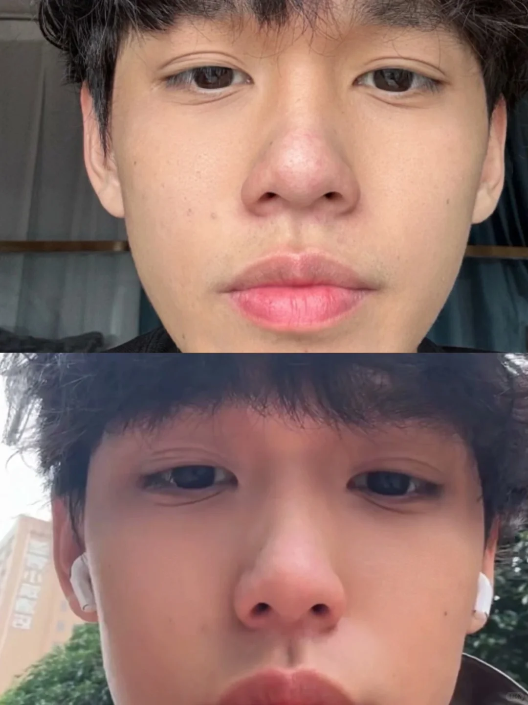 缩完鼻翼兄弟说没必要，没区别吗？