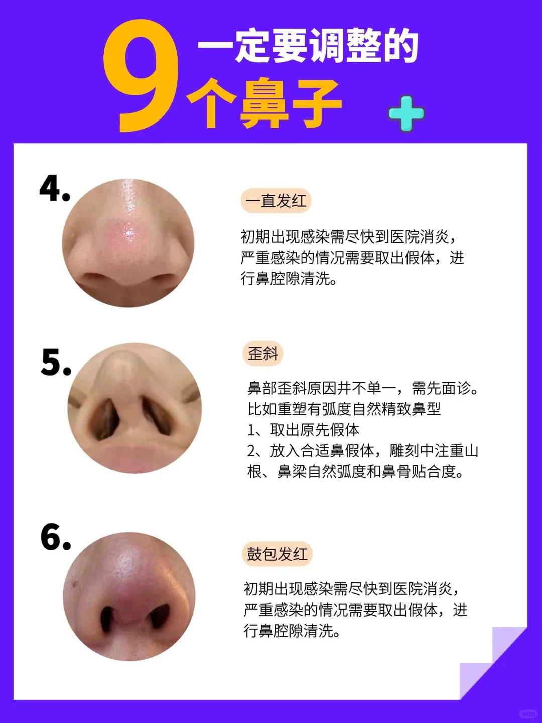 9个调整鼻型的方法