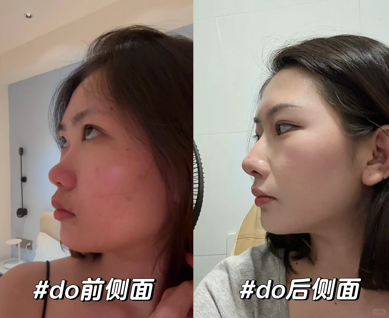 重生之我do了个鼻