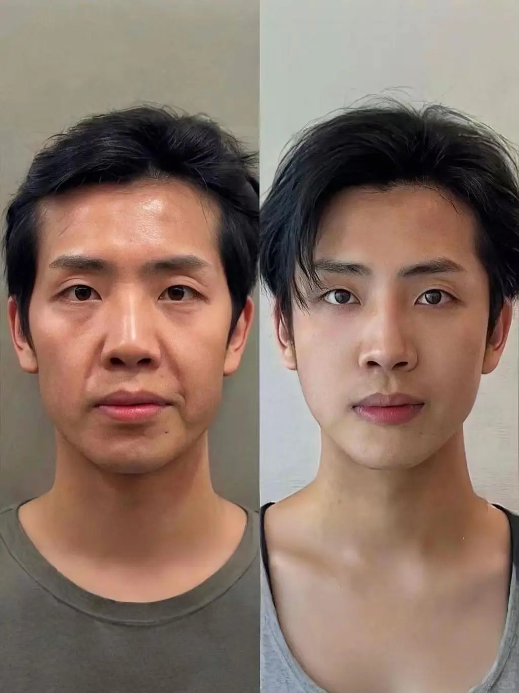 在南昌打造骨相男神丨这才是微调界的颜霸