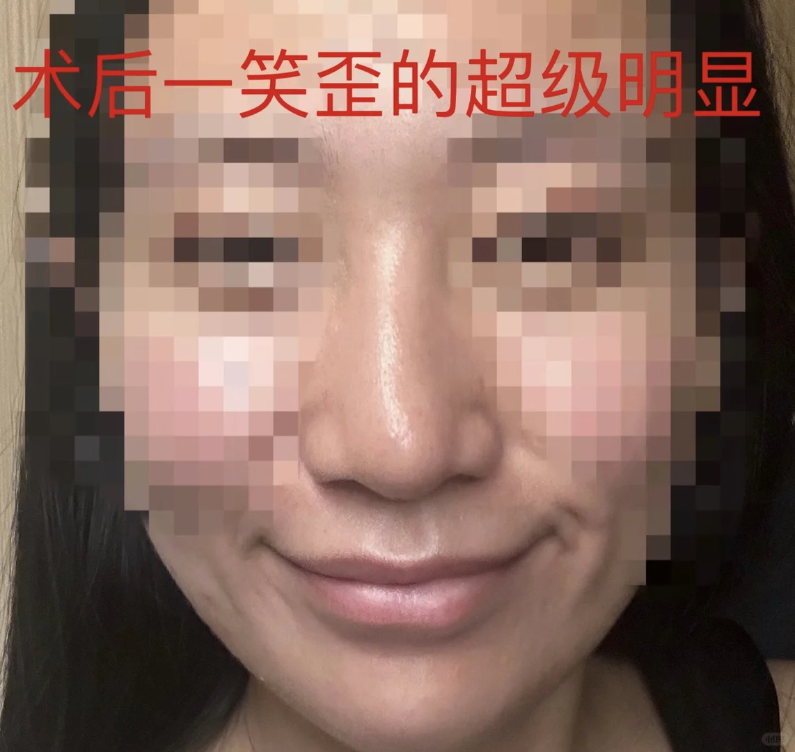 南京术后纯分享