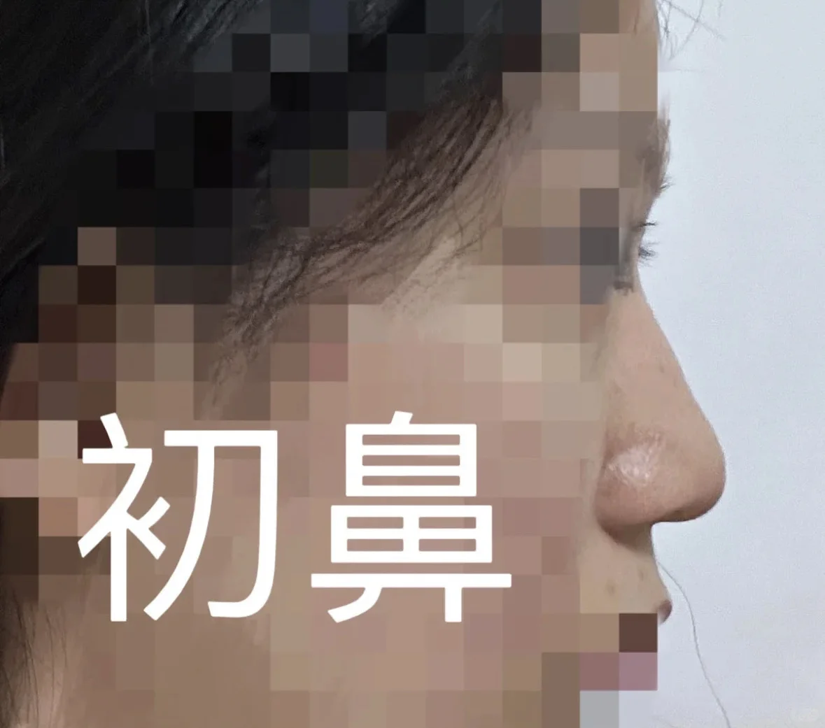 南京术后纯分享