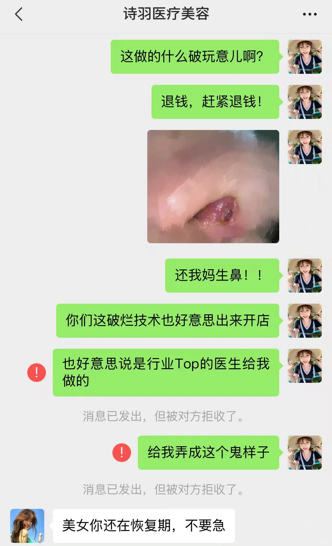 隆鼻失败不手软，强硬手段成功退费！