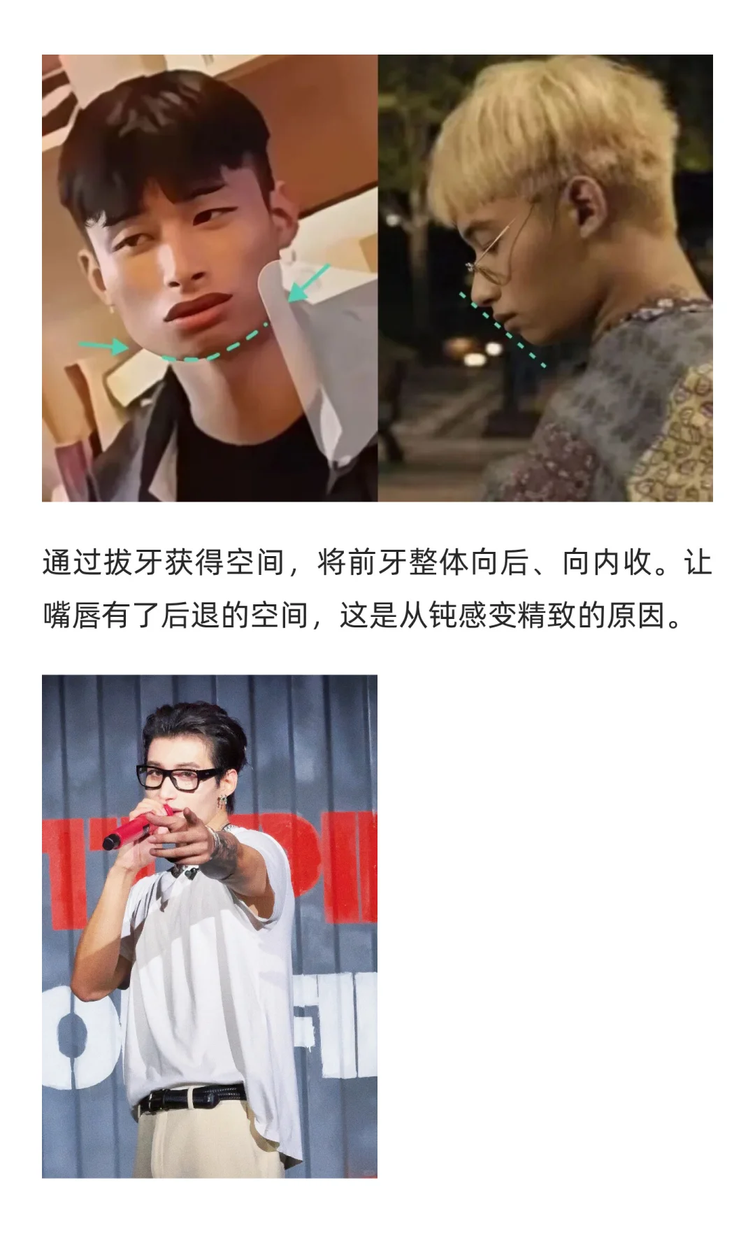 38w换头，支持男生都去卷颜值