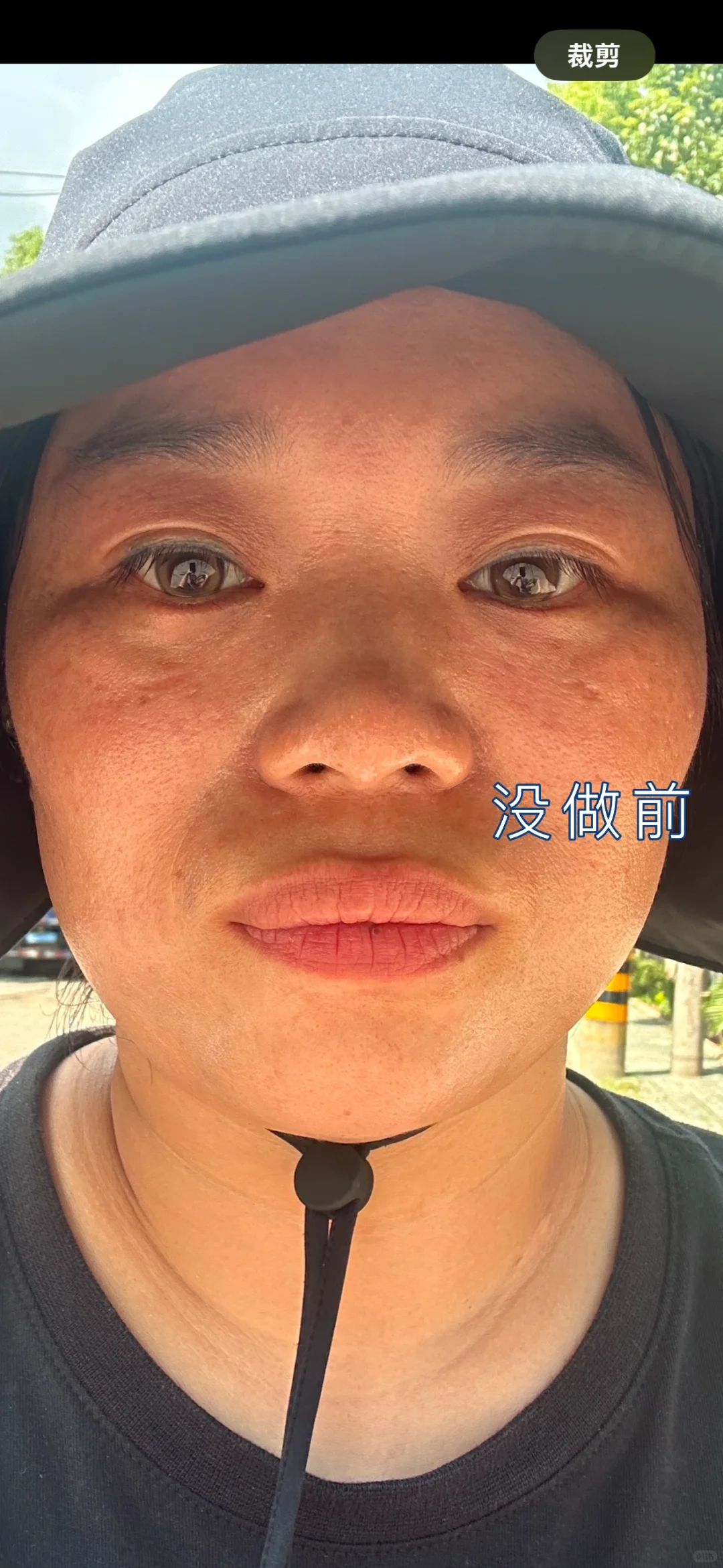 鼻子biu 的第五天