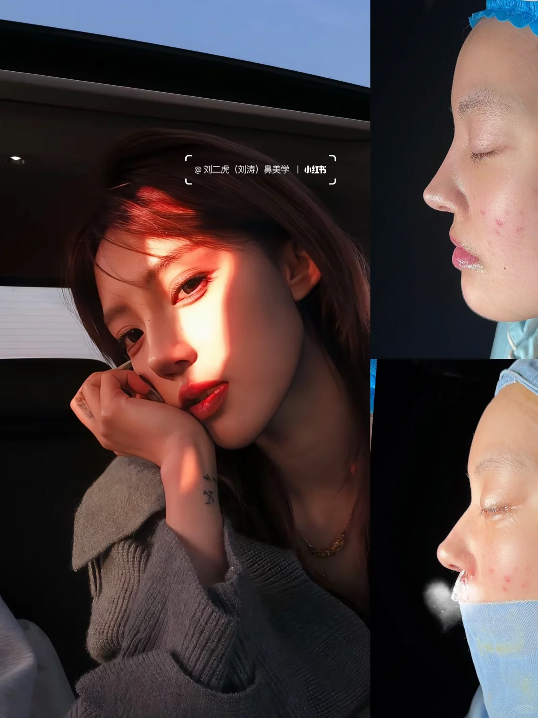 网红猪有蹄🔥一年do鼻分享