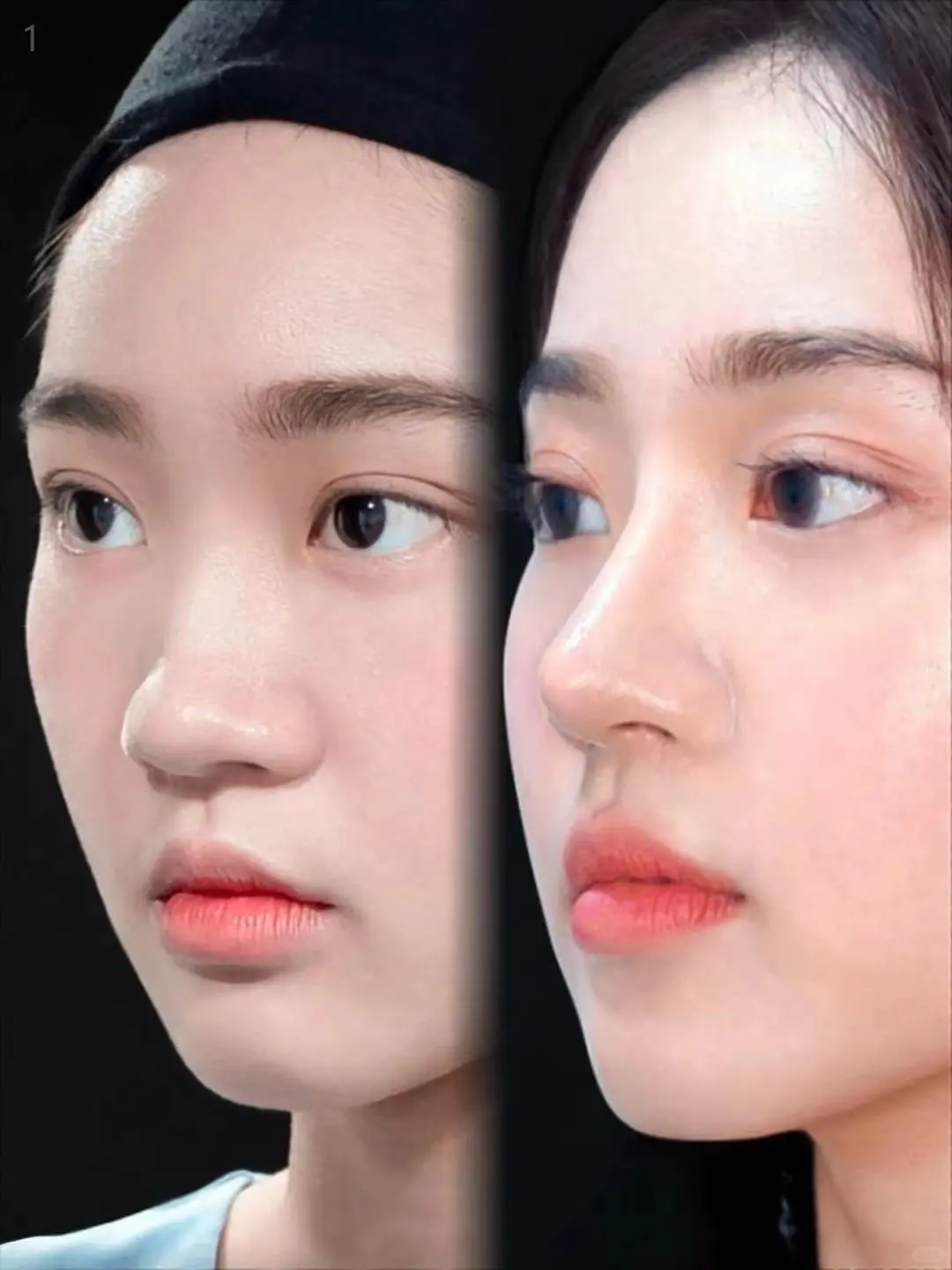 没有对比就没有伤害,妈生鼻V再生鼻