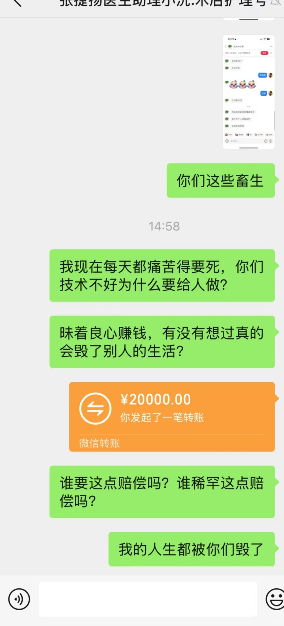 别再去做缩鼻翼了谁做谁后悔