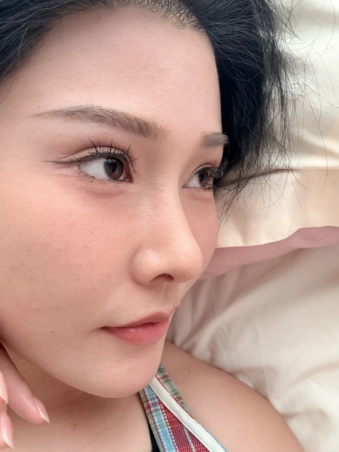 鼻子做完一个月啦！原相机