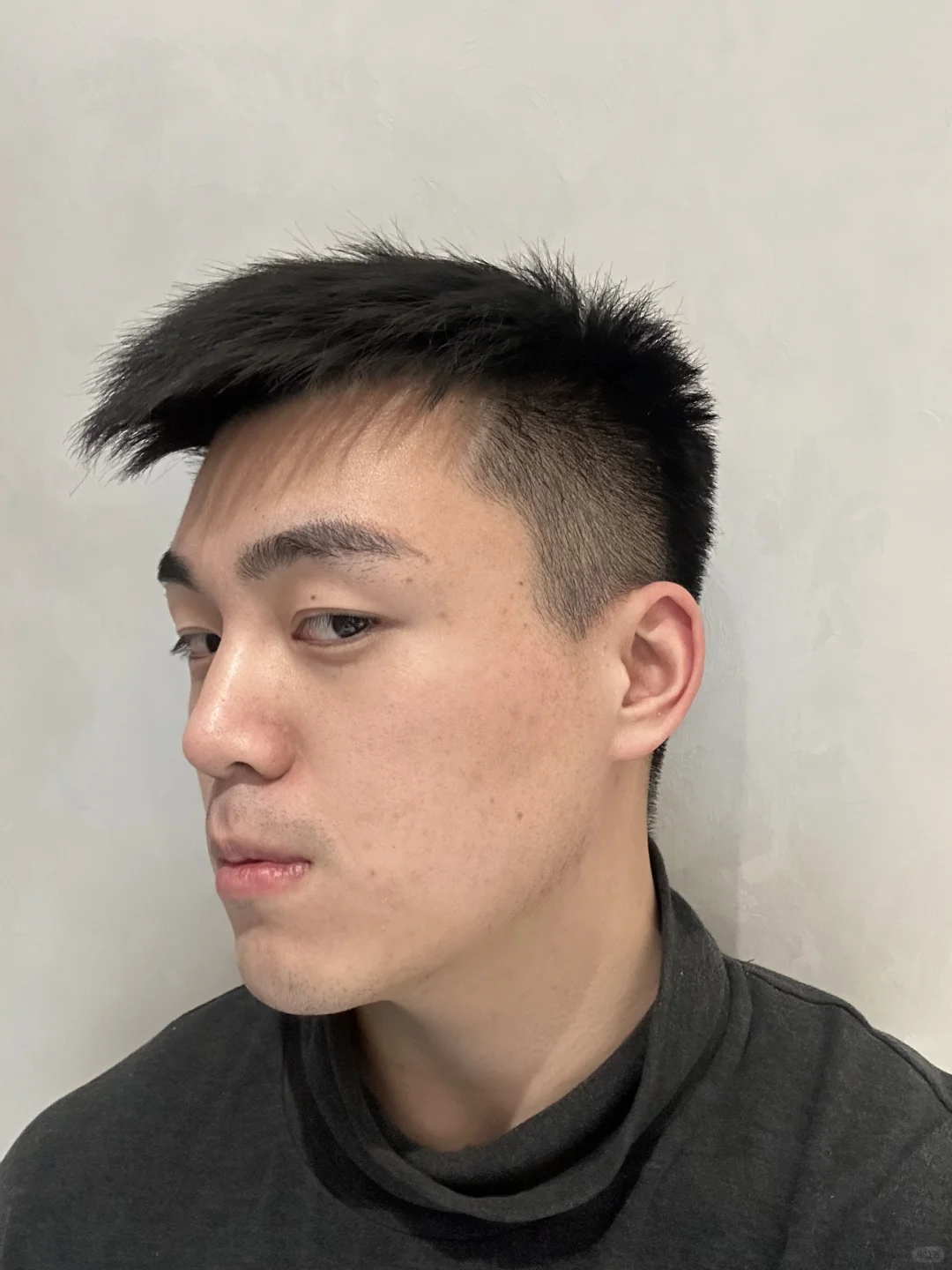 4支Radiesse👃上岸成功