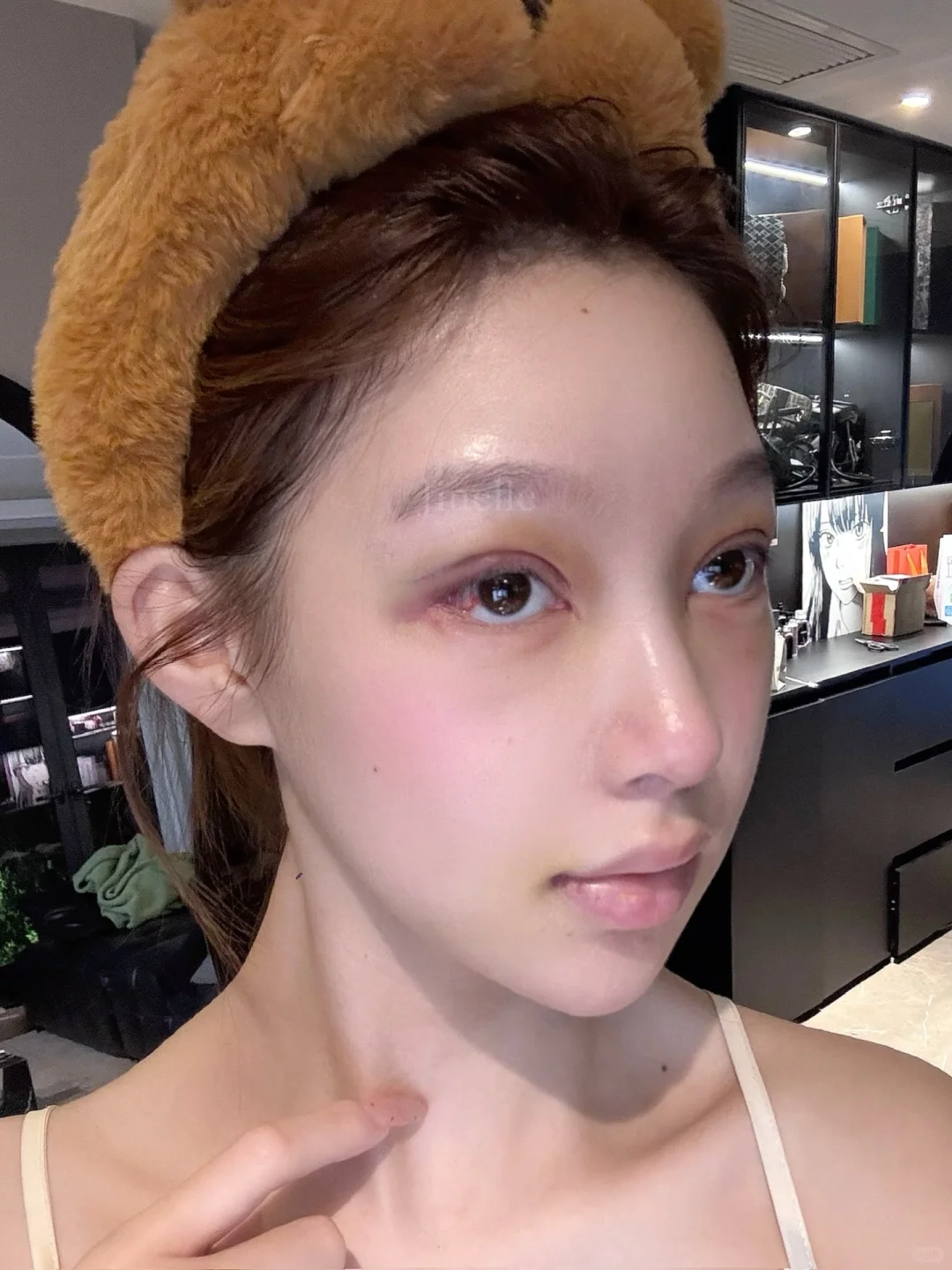 为什么修个👀鼻青脸肿