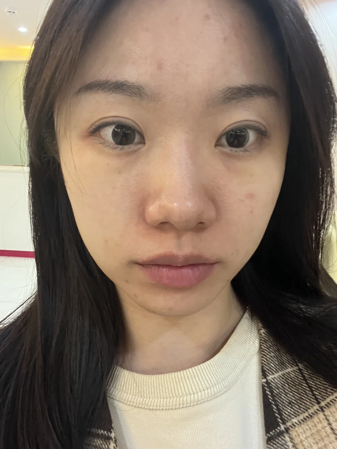 20w💰换回的脸你说值不值【左滑有惊喜】🙂‍↔️