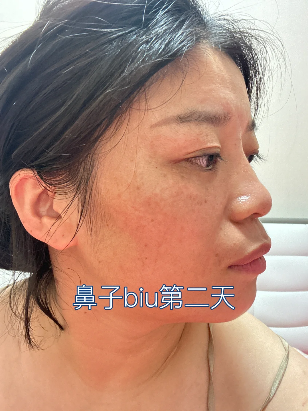 鼻子biu 的第五天