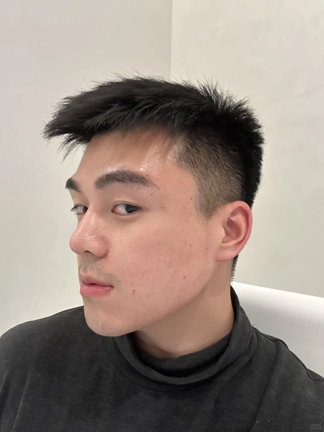 4支Radiesse👃上岸成功