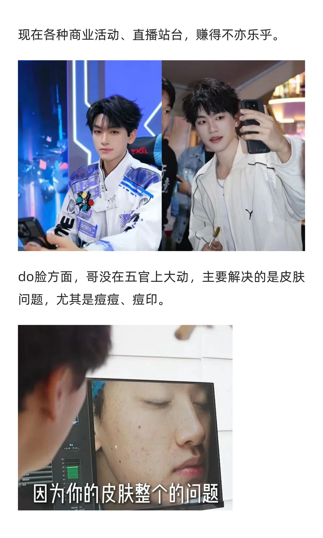 38w换头，支持男生都去卷颜值