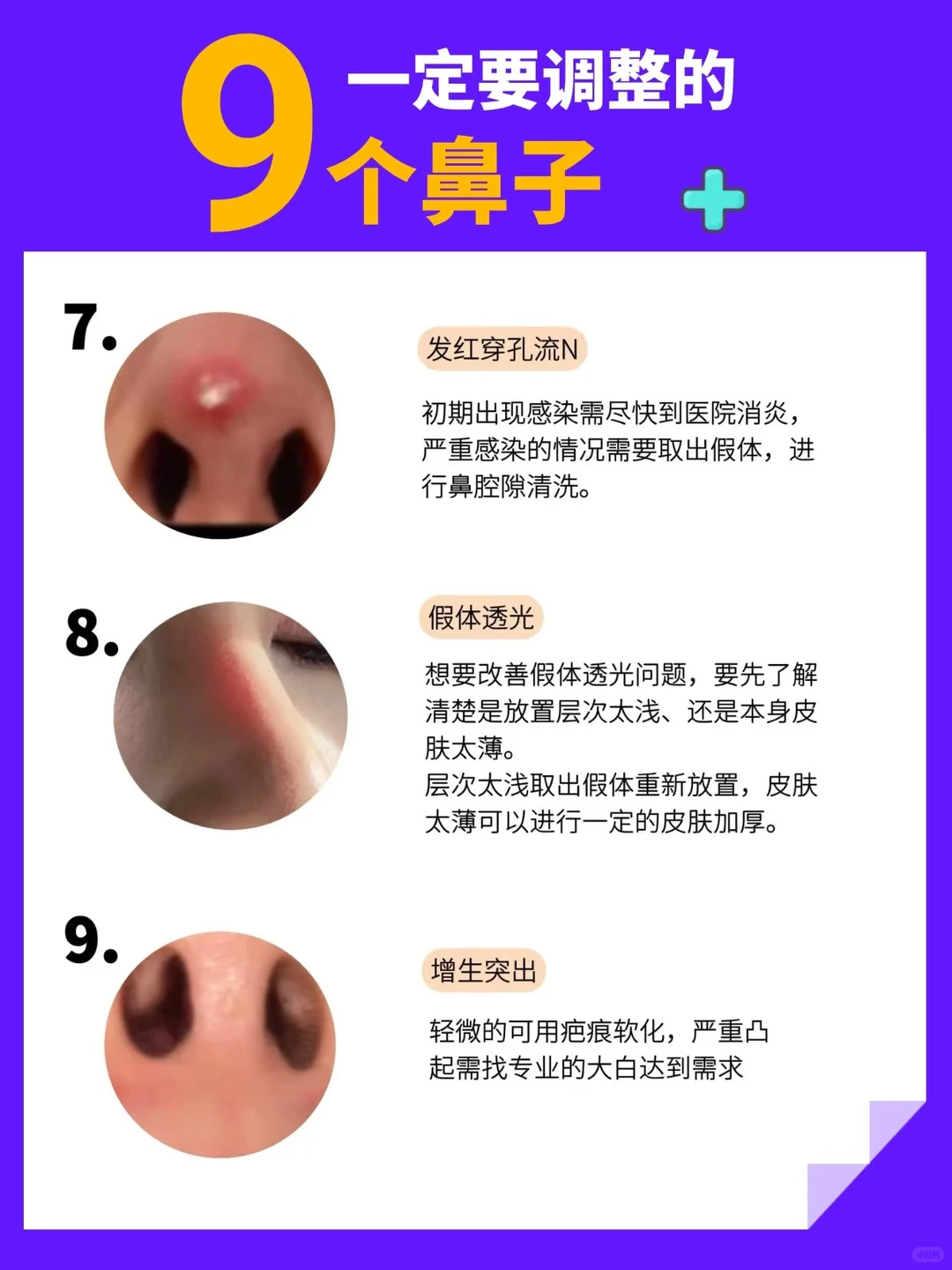 9个调整鼻型的方法