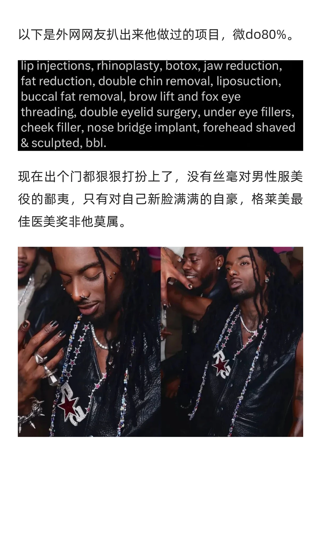 38w换头，支持男生都去卷颜值