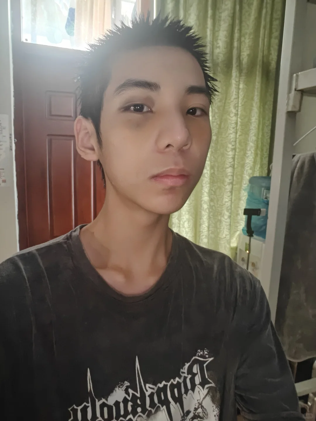 蹲的来看!do鼻9天脸和鼻子都消肿了很多啦