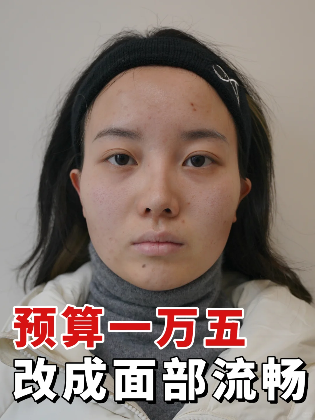 预算一万五👏面部轮廓流畅美爆了