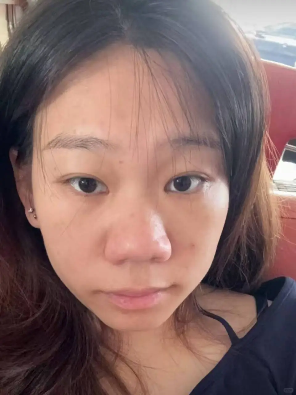 求助：我这个鼻子do什么