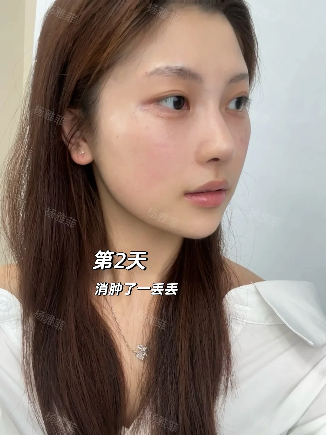 普通人打完啵啵1周变化，上岸了吗？