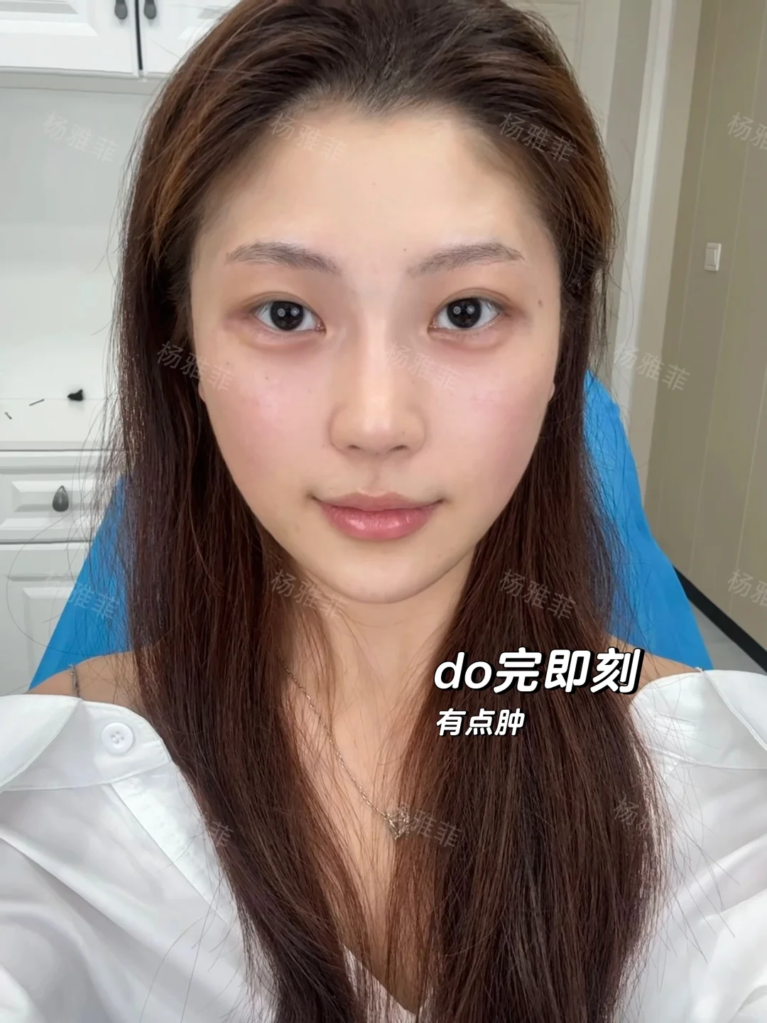 普通人打完啵啵1周变化，上岸了吗？