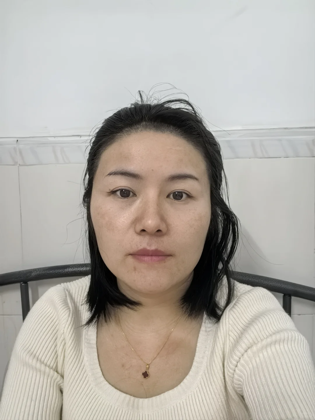 隆鼻原本甜妹系，现在显男相？