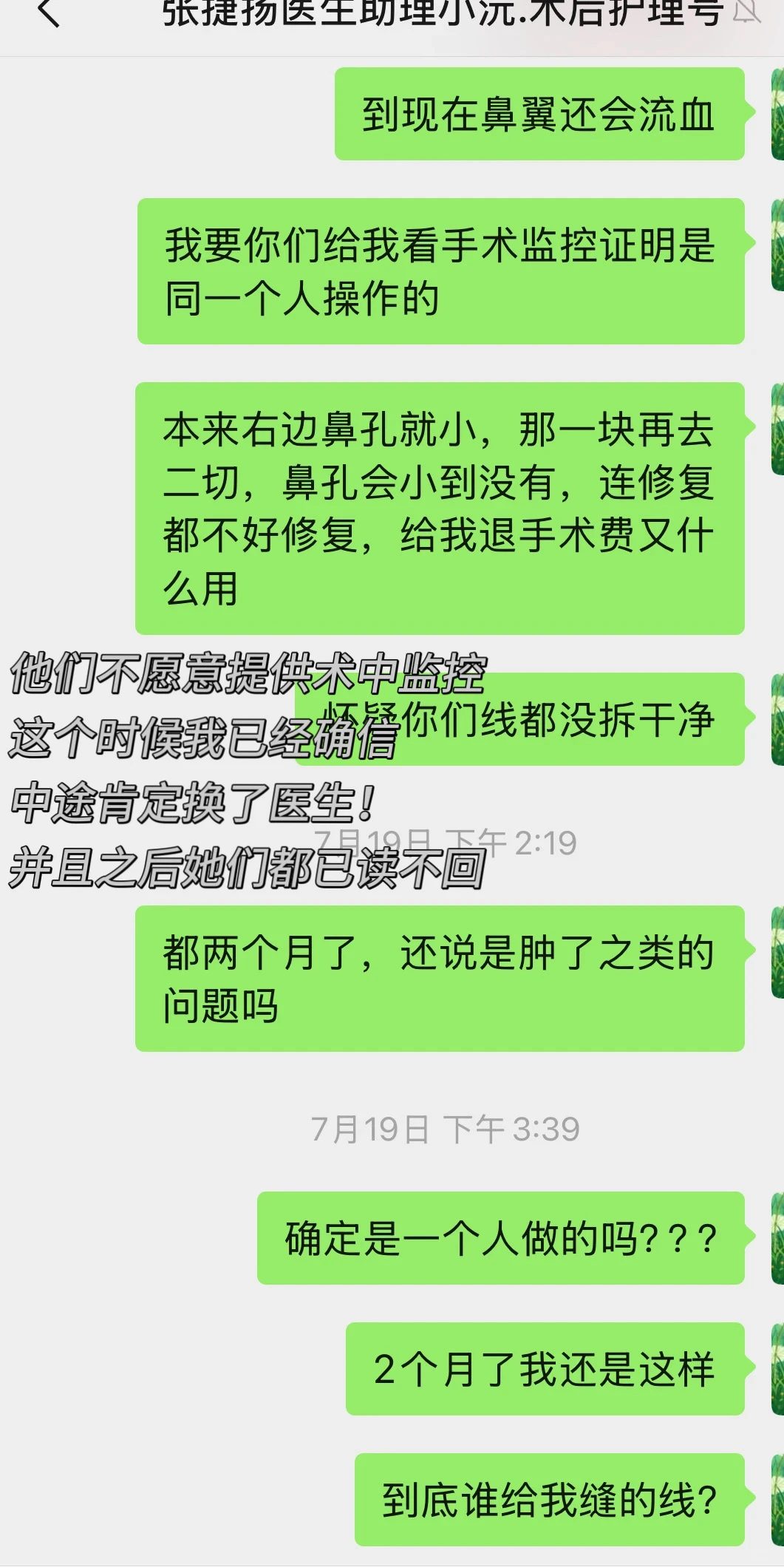 别再去做缩鼻翼了谁做谁后悔