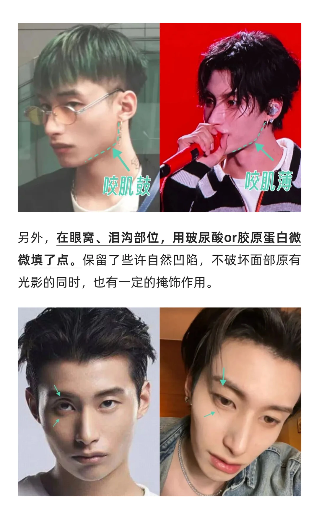 38w换头，支持男生都去卷颜值