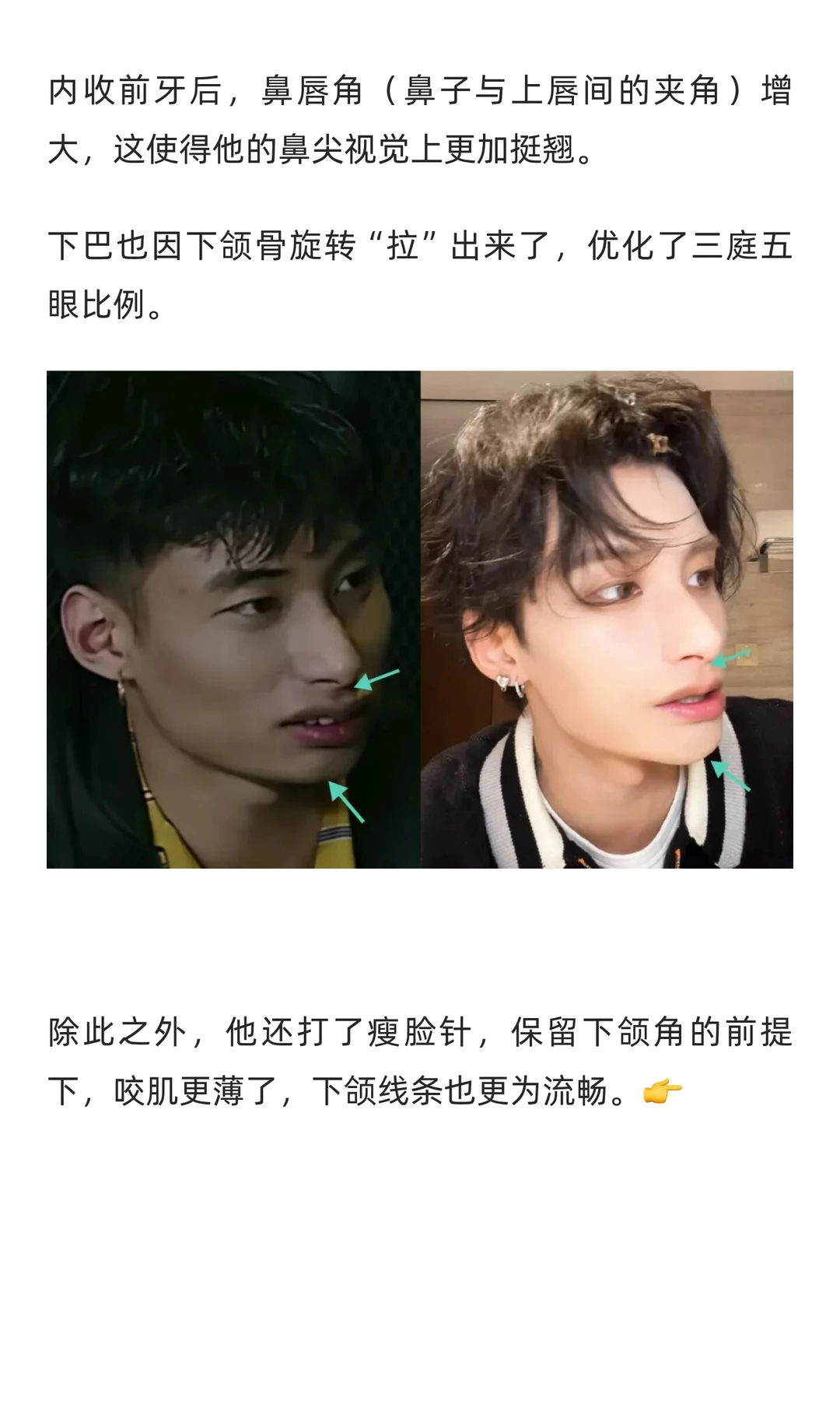 38w换头，支持男生都去卷颜值