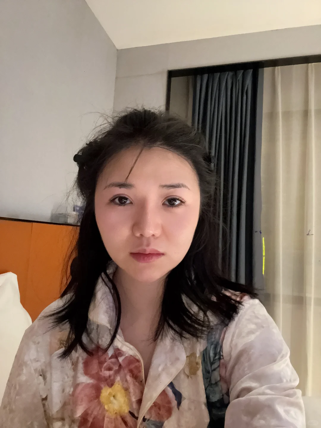 来长沙做鼻子了 手术完成后续