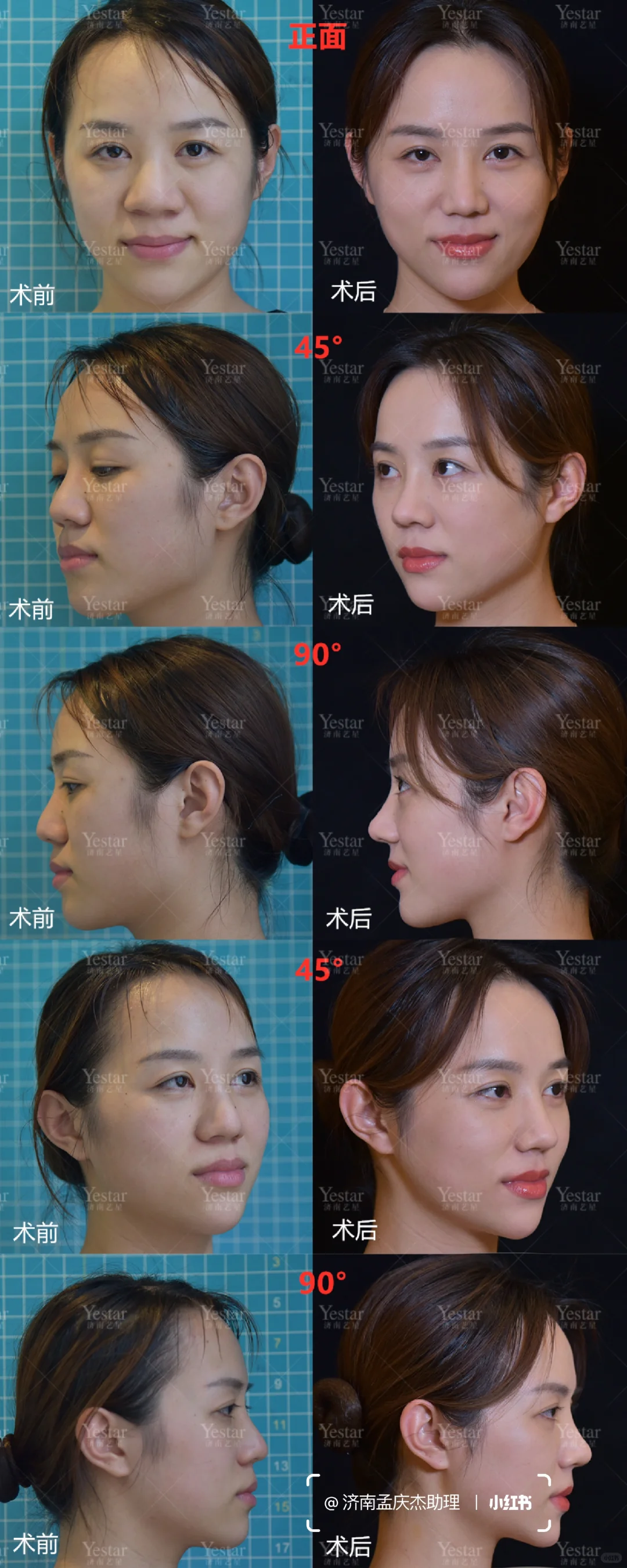 各种角度的鼻子