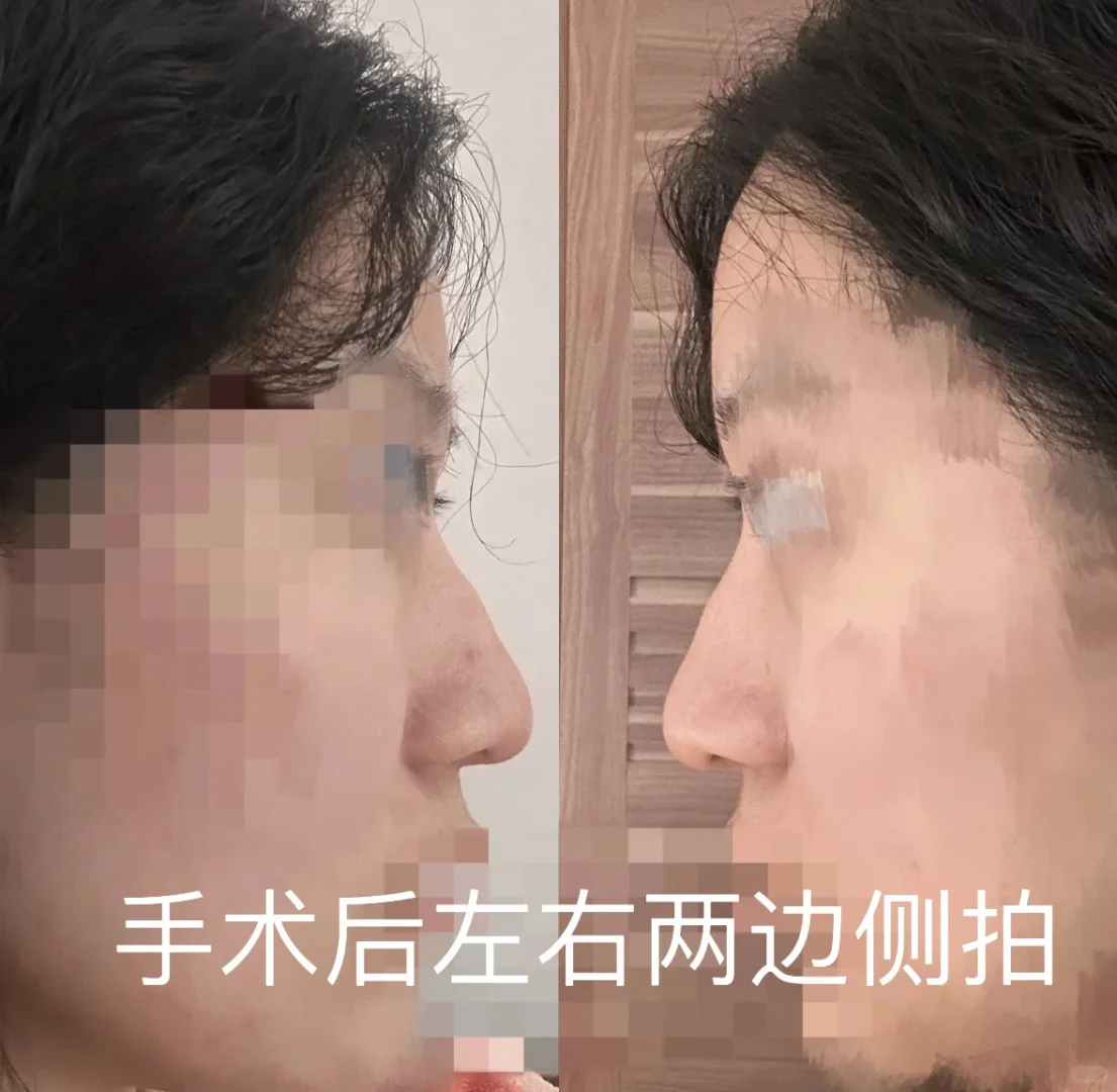 南京术后纯分享