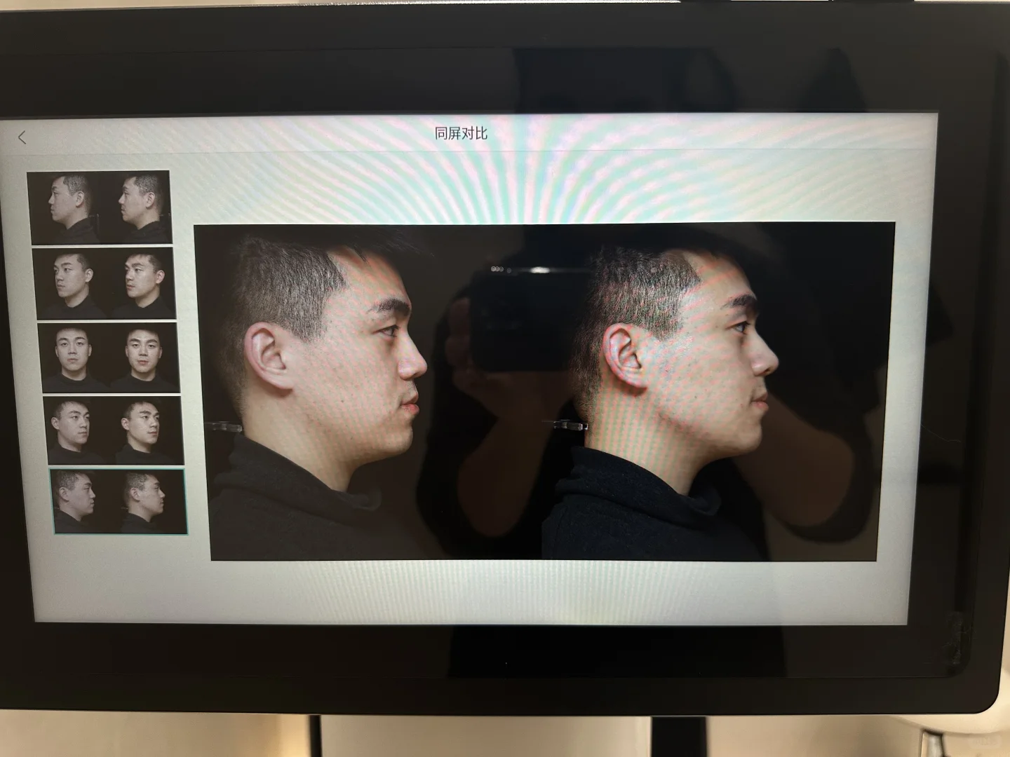 4支Radiesse👃上岸成功