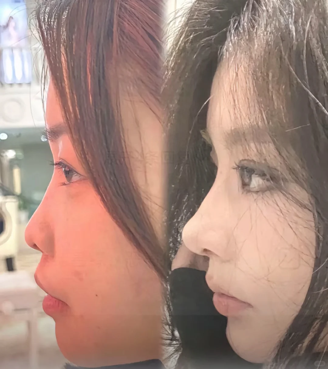 大数据请帮我推给侧脸很虐的姐妹我有话说！