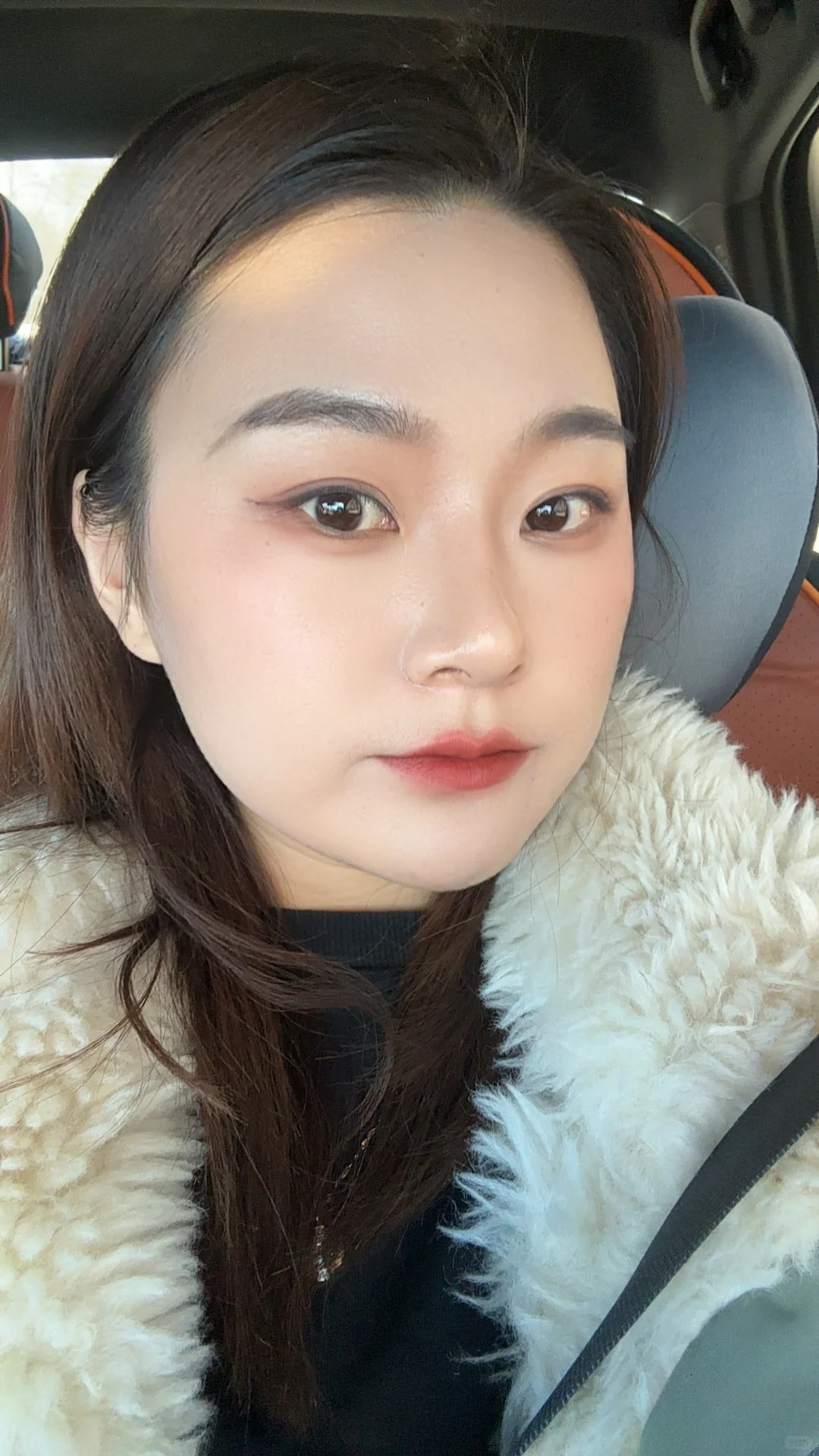 鼻假体取出100天啦