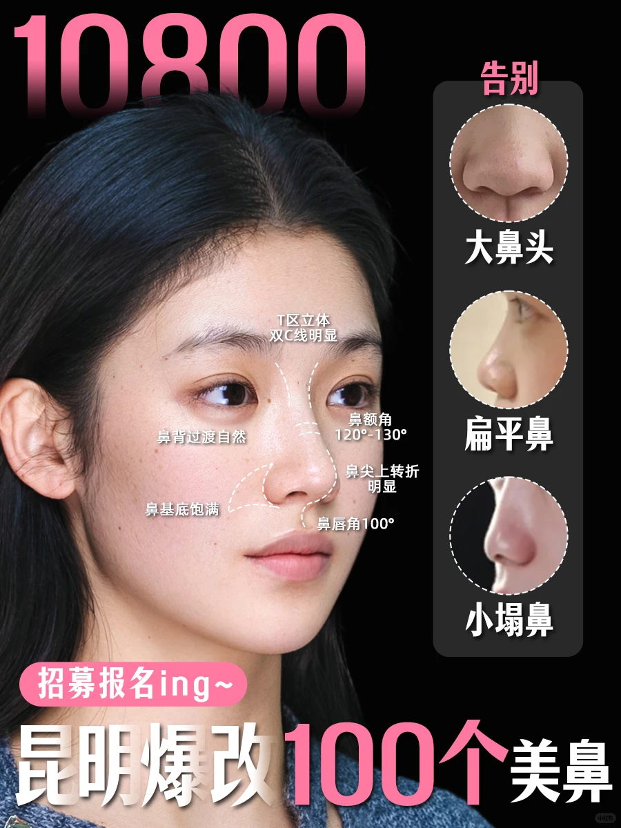 昆明📍素人美鼻招募🔥挑战爆改100个丑鼻子
