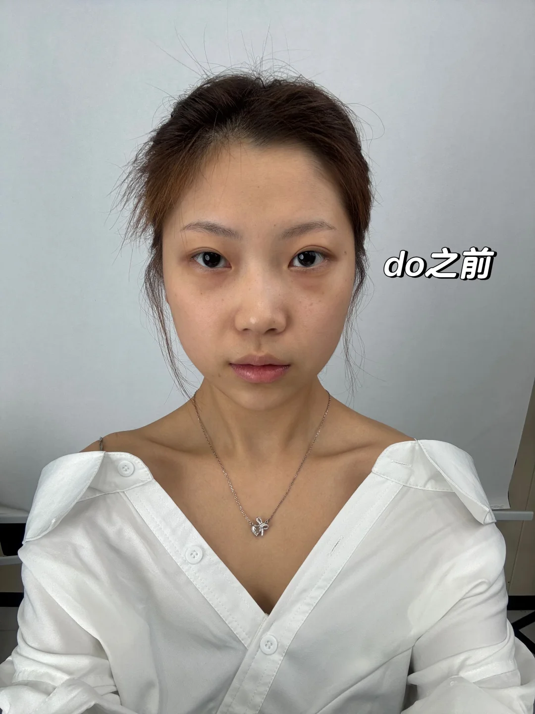 普通人打完啵啵1周变化，上岸了吗？