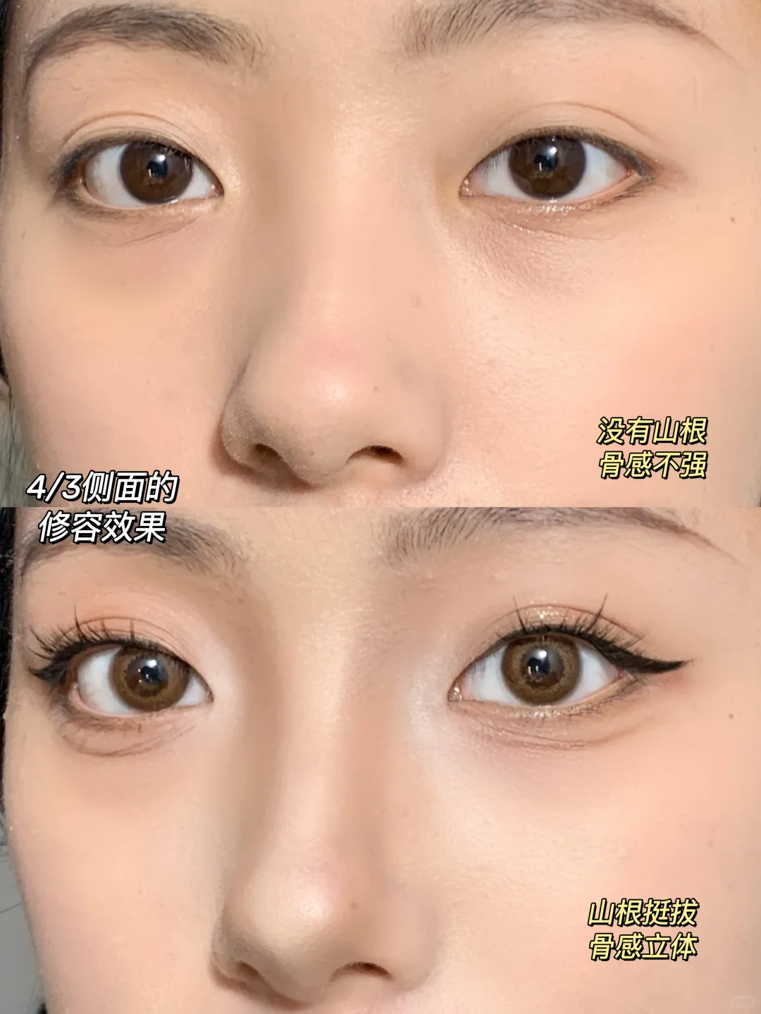 1新手学修鼻大法！傻瓜式10v修鼻技巧