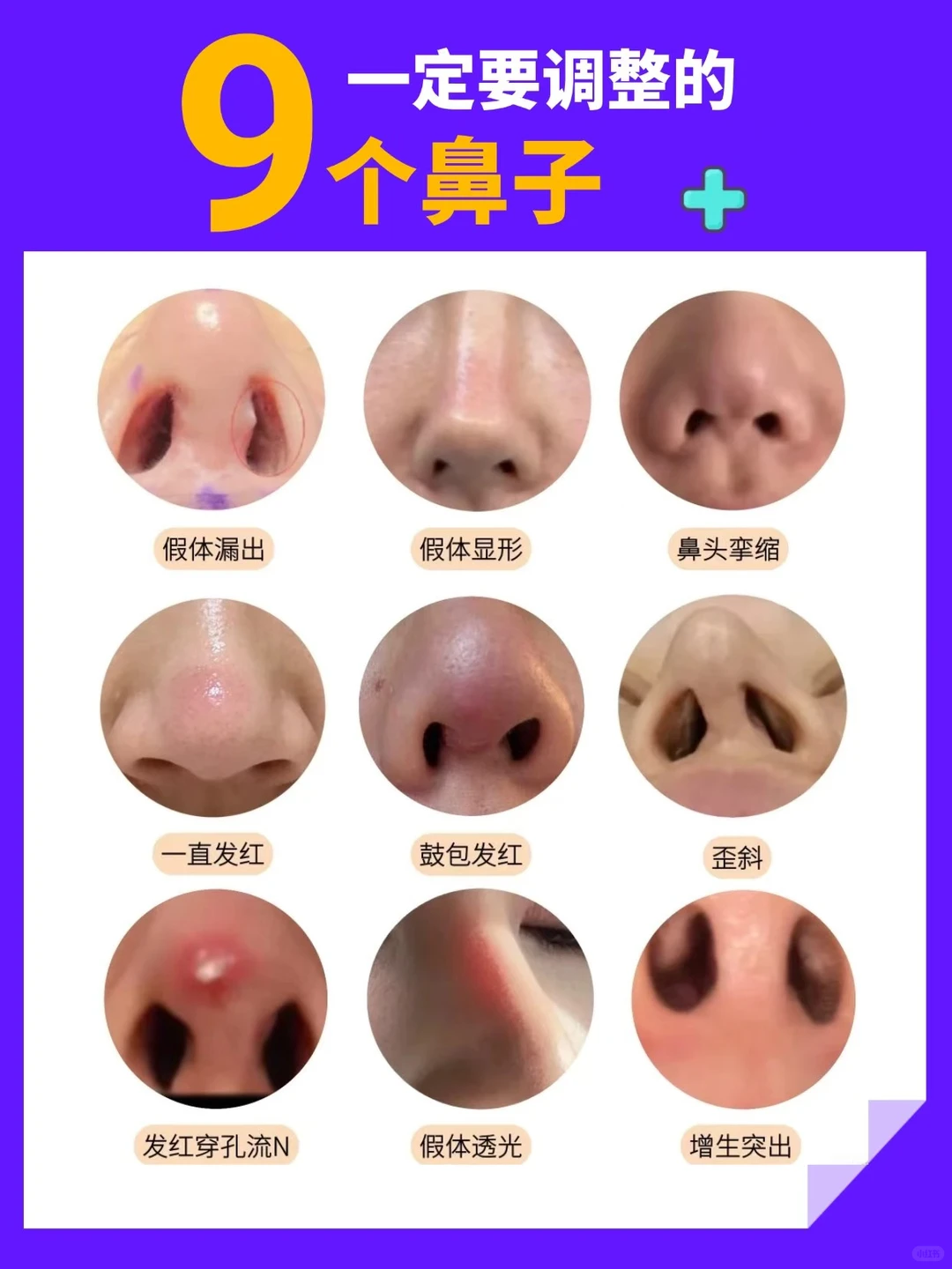 9个调整鼻型的方法