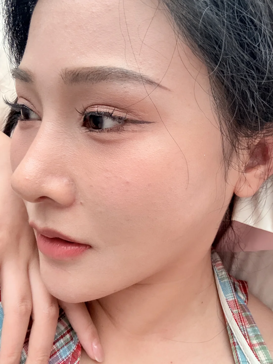 鼻子做完一个月啦！原相机