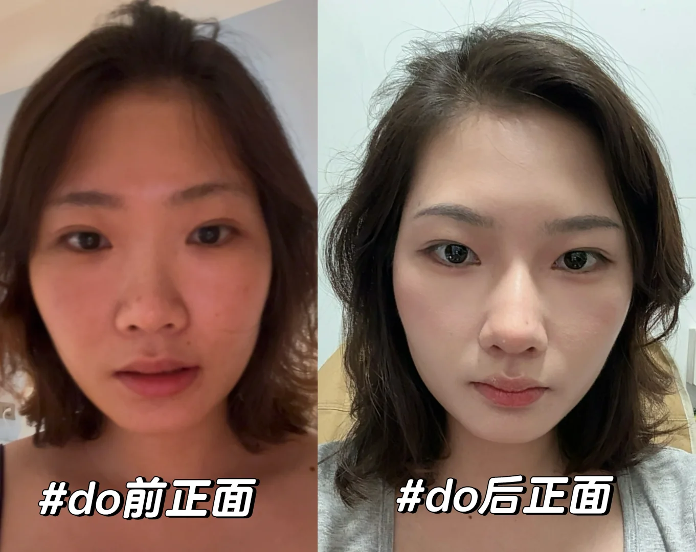 重生之我do了个鼻